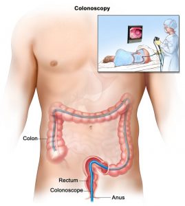 How is virtual colonoscopy different from colonoscopy?