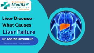 Liver Diseases- What Causes Liver Failure?