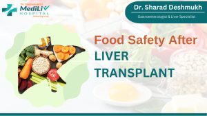 Food Safety after Liver Transplant:  What Do the Expert Says