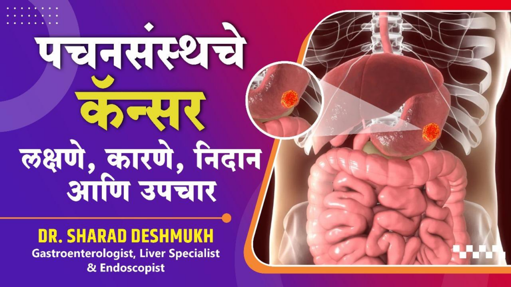 Detect, Defend, Defeat: Mastering Gastrointestinal Cancer Awareness – Symptoms, Causes, Diagnosis, and Beyond – Dr. Sharad Deshmukh (Gastroenterologist, Liver Specialist & Endoscopist at Mediliv Hospital Nashik