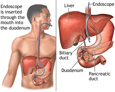 Liver Treatment In Nashik | Liver Transplantation in Nashik