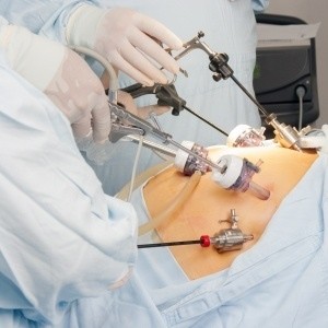 laproscopic gynac surgery in nashik