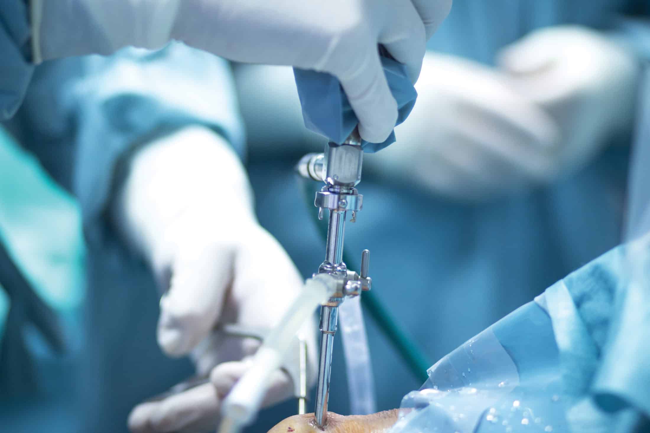Orthopedics.F17-1-e1504818928899